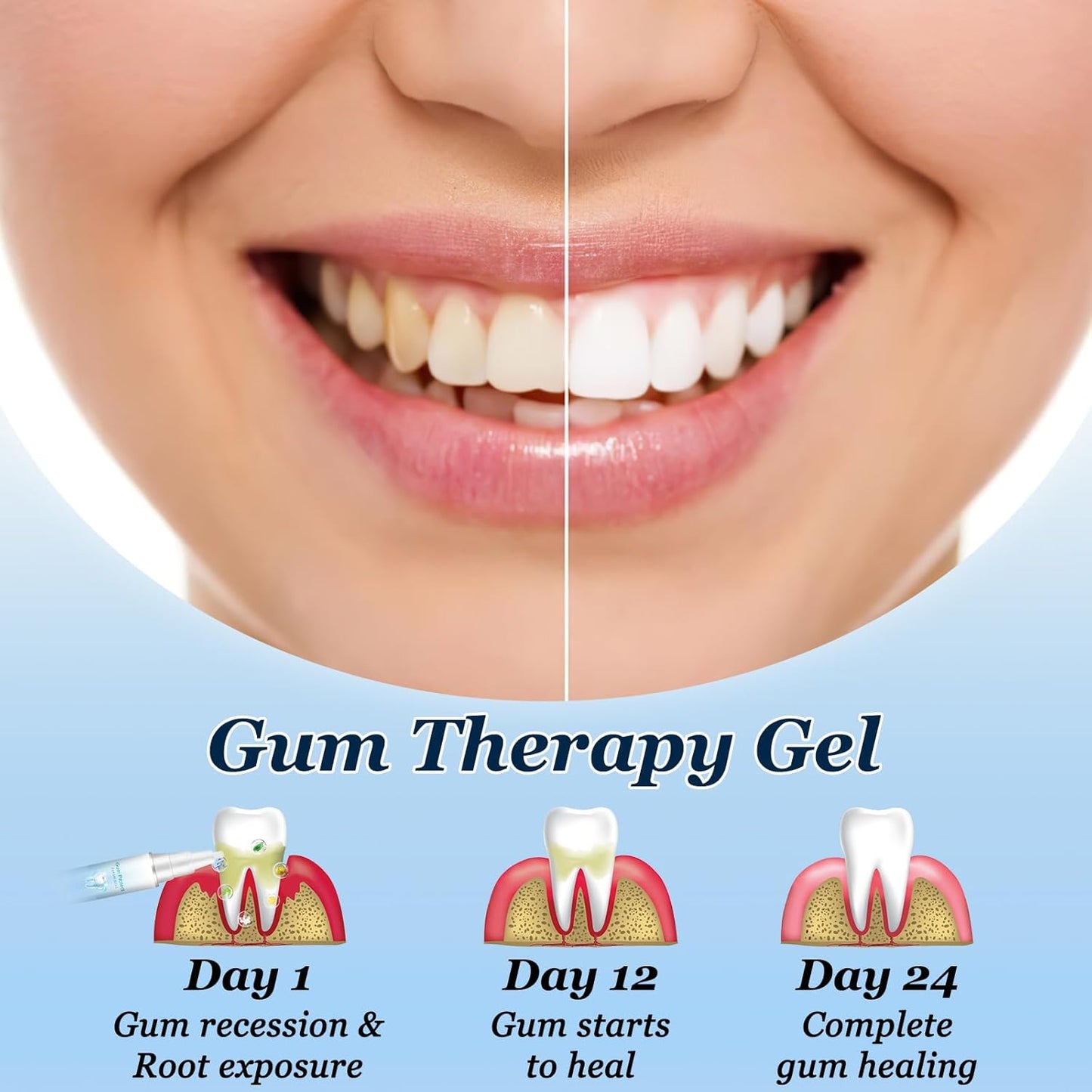 Neslemy Gum Shield Therapy Gel, Instant Treatment Essence, Dentizen Gum Therapy Gel, Teeth Whitening Essence Pen (3PCS)