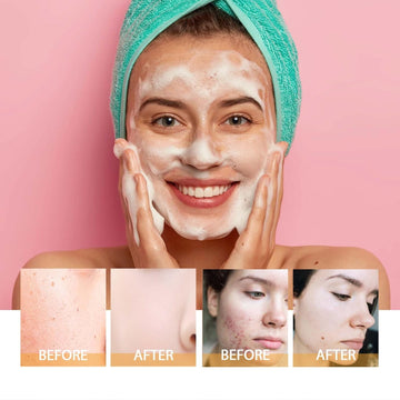 Reveal Your Radiance and Embrace Glowing Skin